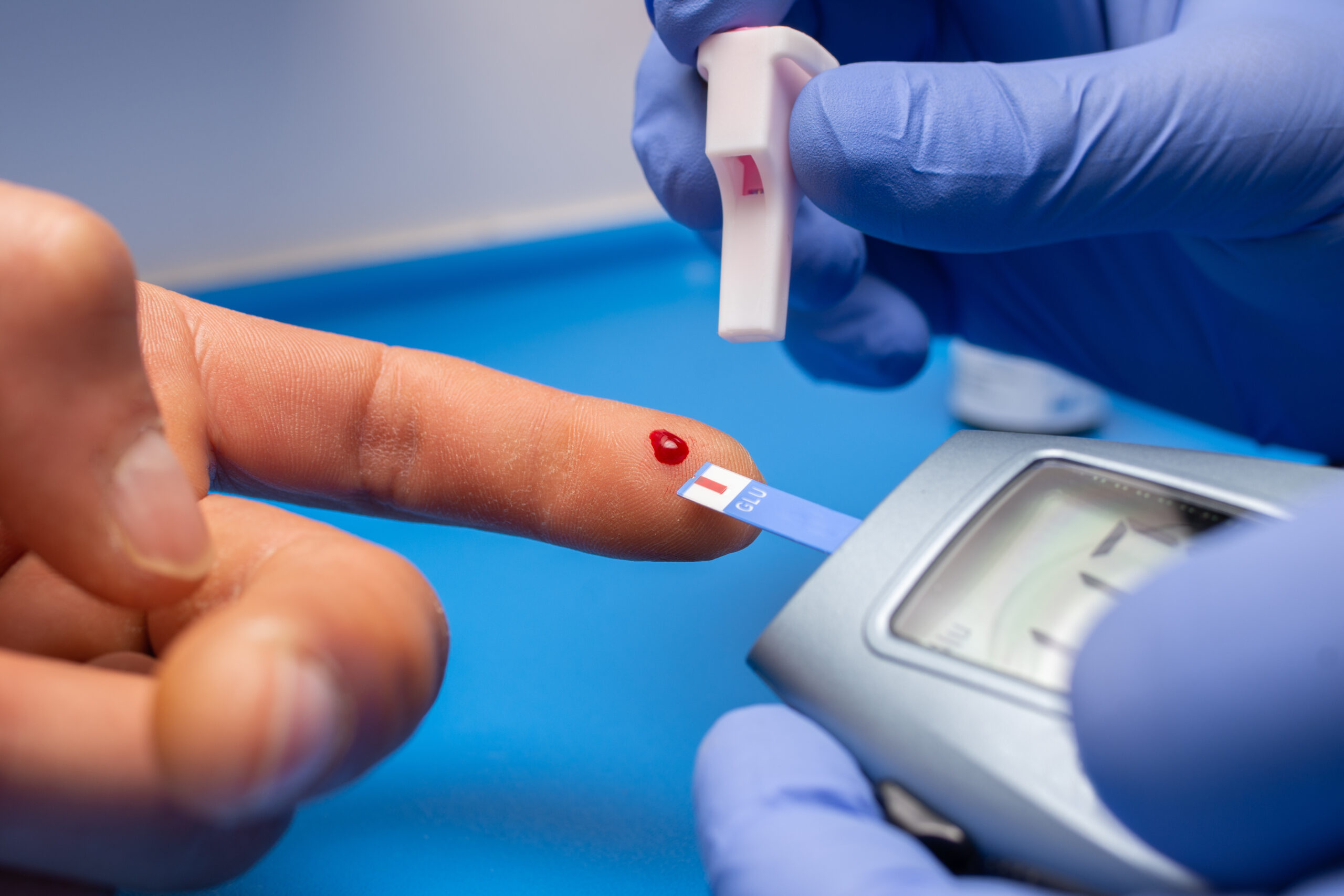 Closeup shot of a doctor with rubber gloves taking a blood test from a patient A closeup shot of a doctor with rubber gloves taking a blood test from a patient